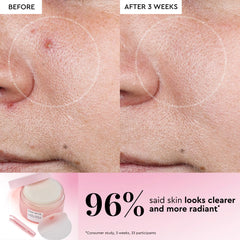 LHA + AHA Korean Watermelon Toner Pads